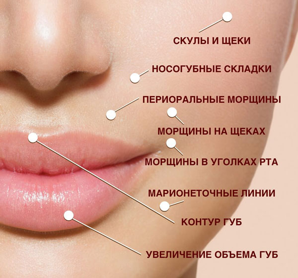 контурная пластика