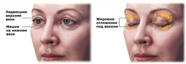 виды коррекции